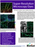 Super-Resolution Microscopy 이미지