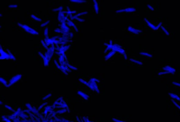 박테리아 형광 이미징 | Bacteria Imaging | FDAA 형광 Probe 이미지