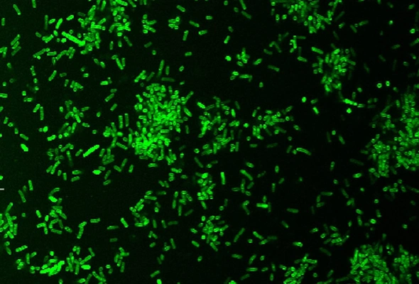 박테리아 내생포자 염색 | BactoSpore™ Bacterial Stains 이미지