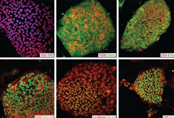 [R&D Systems] Pluripotent Stem Cells Antibody Panels 이미지