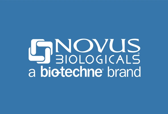 [NOVUS BIOLOGICALS] 제품바로가기 이미지