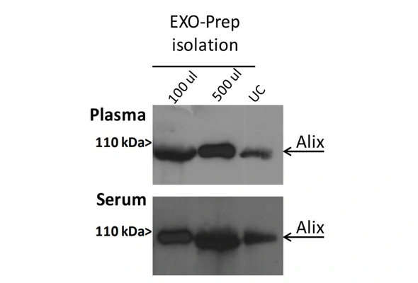 [Novus] Exosome Isolation | 엑소좀 분리 컬럼, 비드, 침전용액 이미지
