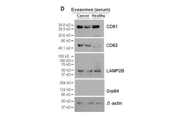 [Novus] Exosome Detection Antibody Pack 이미지