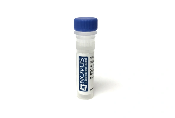 [Novus] Recombinant Monoclonal Antibody 이미지