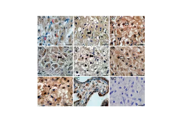 [Novus] IHC Tissue Slides 이미지