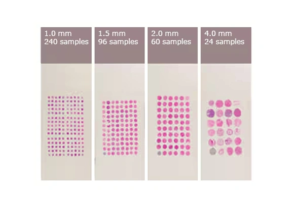 [Novus] Tissue Microarrays (TMA) 이미지