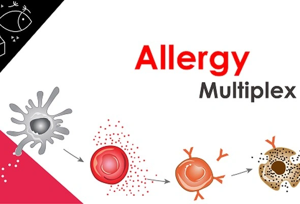 Human Allergy Multiplex ELISA Kit 이미지