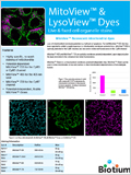 MitoView™ & LysoView™ Organelle Stains 이미지