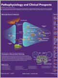 Huntington's Disease Poster 이미지