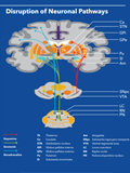 Parkinson’s Disease: Neurobiology and Therapeutic Strategies 이미지