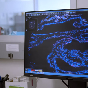 [ACD] RNA ISH Assay Service 이미지