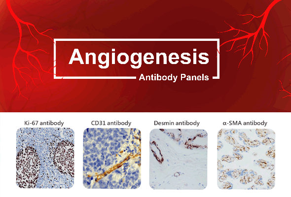 Angiogenesis & Microvascular Density Antibody Panel 이미지