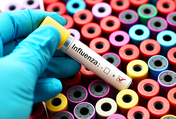 Influenza Antibody & Protein 이미지