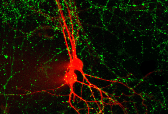 신경다발 염색 | Nerve Terminal Staining Dye 이미지