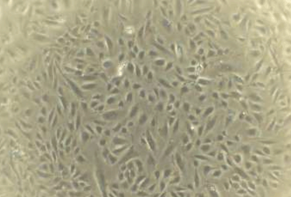 Human Umbilical Vein Endothelial Cells | HUVEC Cell 이미지