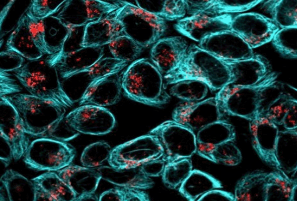 ViaFluor® Live Cell Microtubule Stains | Cytoskeletal Stains 이미지