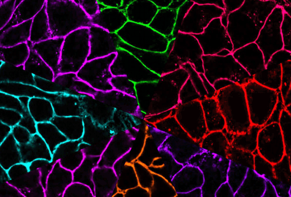 CellBrite® Membrane Stain | Membrite® Cell Surface Stain 이미지