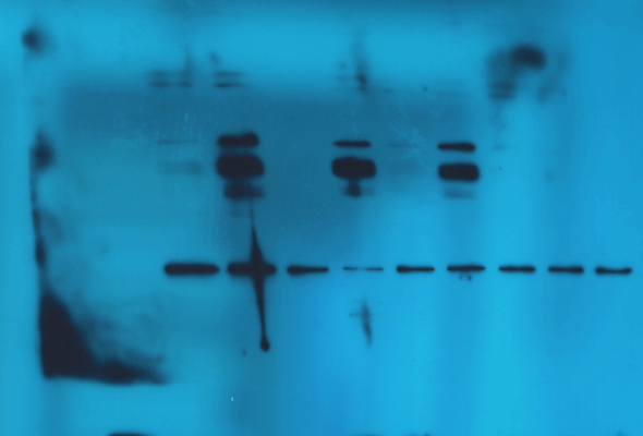 ECL Western Blot Substrate Kit 이미지