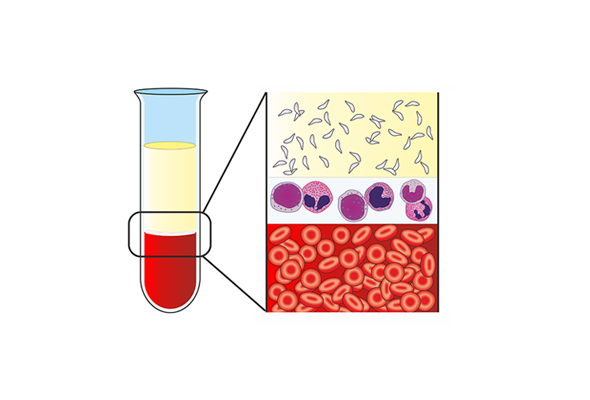 Cell Separation Media 이미지