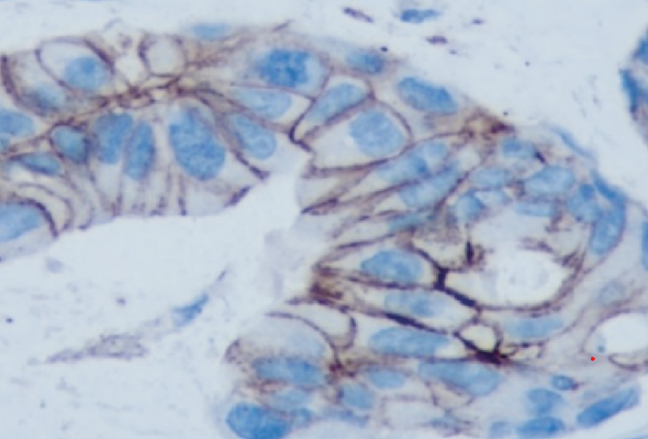 Epithelial-Mesenchymal Transition (EMT) 항체 이미지