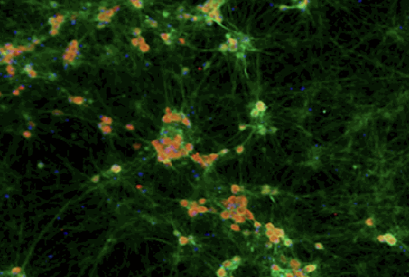 AXOL 감각뉴런 | Sensory Neuron Progenitors & Medium | 통증연구 이미지