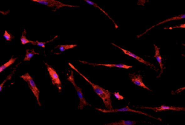 AXOL 미세교세포 | Microglia & Media 이미지