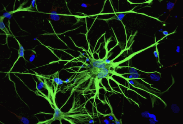 AXOL 성상교세포 | Astrocyte 이미지