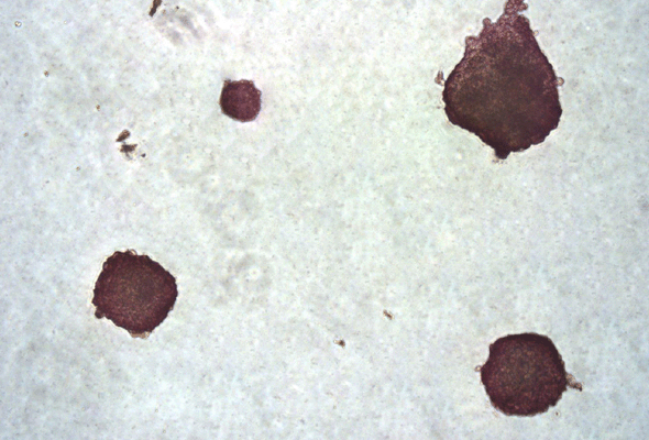 Hematopoietic Colony Forming Cell (CFC) Assay 이미지