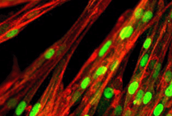 근육세포 | ioSkeletal Myocytes 이미지