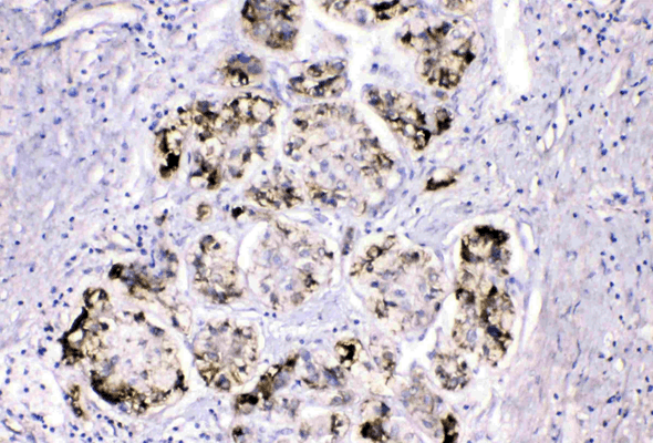 Fibrinogen Antibody & Proteins 이미지