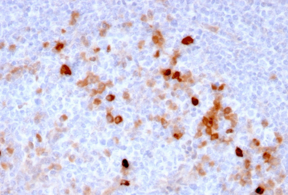 Angiogenesis Marker Antibody 이미지