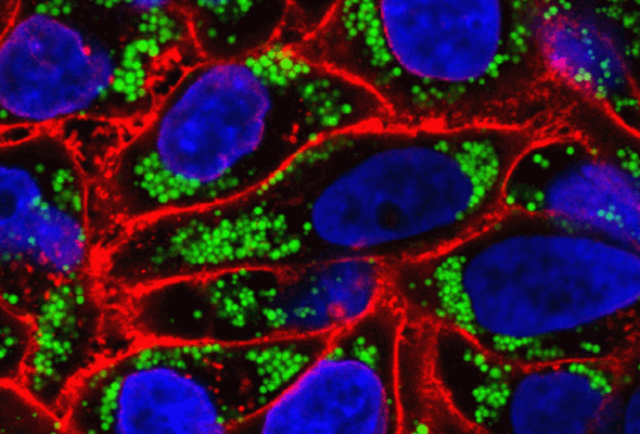 지질방울 염색 | LipidSpot™ Lipid Droplet Stains 이미지