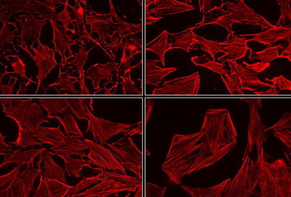 Myofibroblasts & CAFs Antibody Panel 이미지