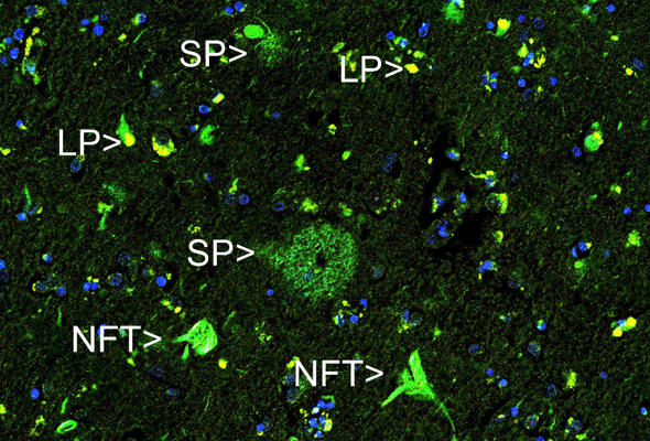 알츠하이머 연구 항체 | Amyloid Beta Antibody 이미지