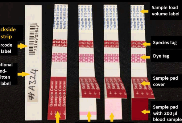 TruStrip™ Rapid Tests Kits 이미지