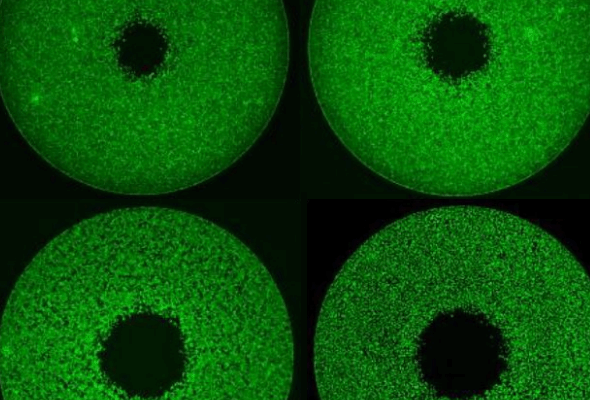 Tumor Cell Migration Services | Cell Migration 분석서비스 이미지