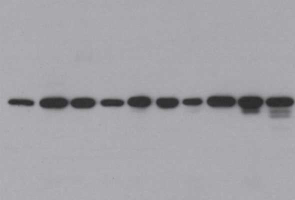 Western Blot Loading Control Detection Set 이미지