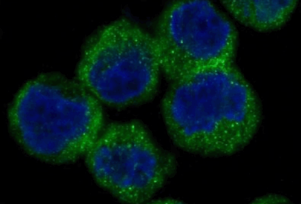 Apoptosis Marker | Apoptosis Antibody 이미지