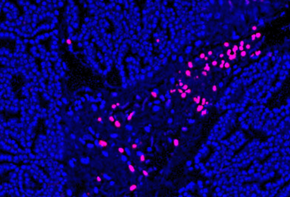 TUNEL Assay Apoptosis Detection Kit 이미지