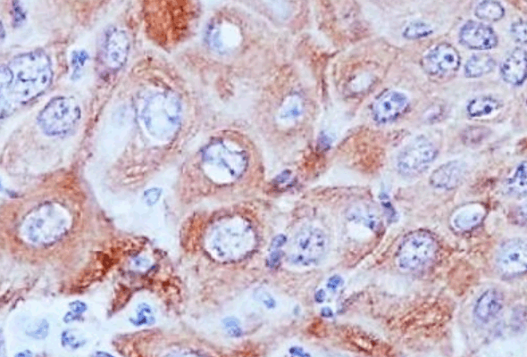 엑소좀항체 패널 | Exosome Antibody Panel 이미지