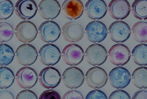 Topoisomerase Drug Screening Kit 이미지