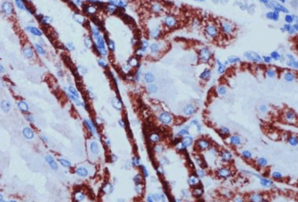 Transferrin Antibody | Transferrin Protein 이미지