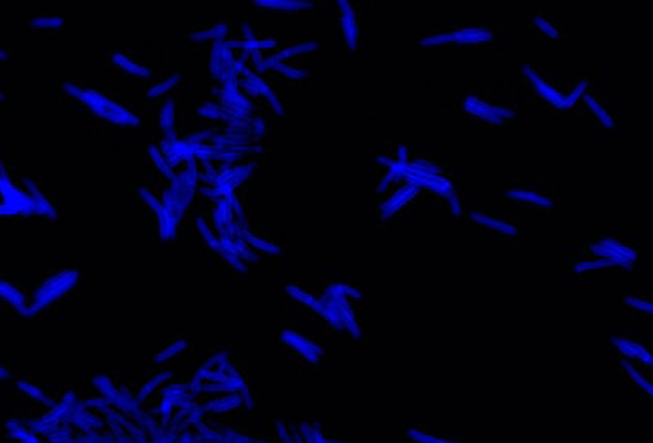 박테리아 형광 이미징 | Bacteria Imaging | FDAA 형광 Probe 이미지