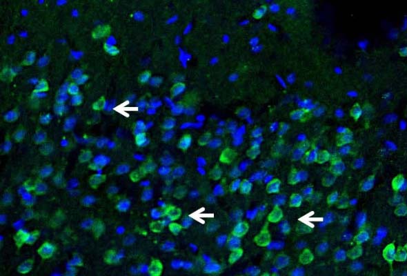 Store-Operated Ca2+ Channel Antibody 이미지