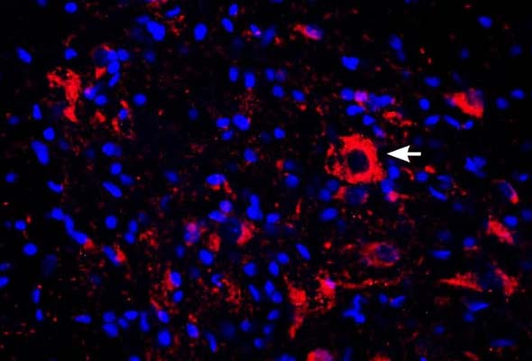 Acid-Sensing Ion Channels (ASIC) Antibody 이미지