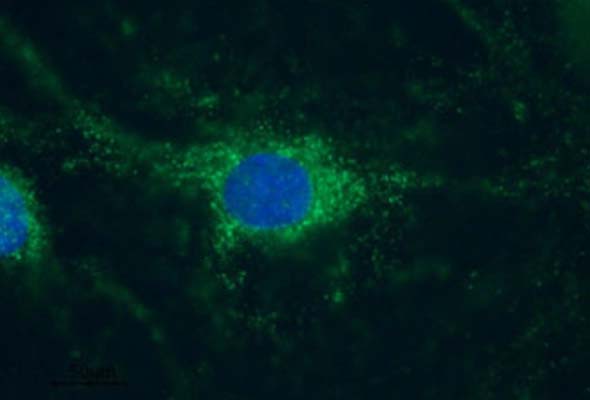 Hyperpolarization-Activated Cation (HCN) Channel Antibody 이미지