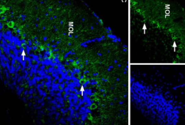 Purinergic (P2X) Receptor Antibody 이미지