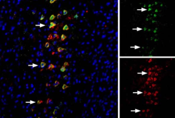 Nicotinic Acetylcholine Receptor Antibody 이미지