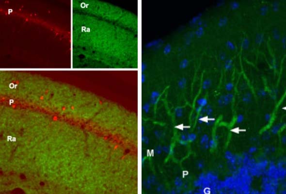 Ionotropic Glutamate Receptor Antibody 이미지