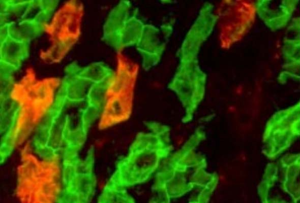 Voltage-Gated Cl- Channels | CLC Antibody 이미지